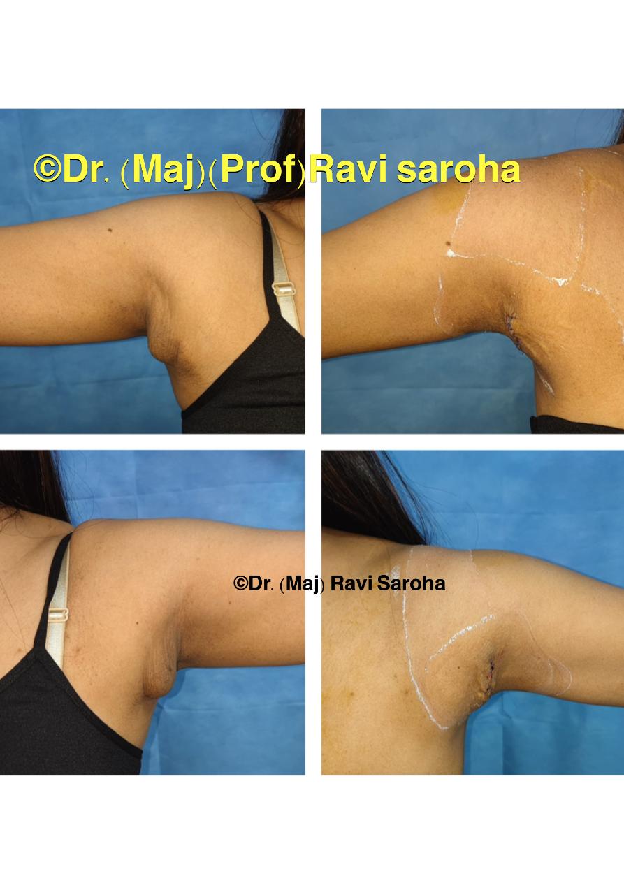 Body Surgery