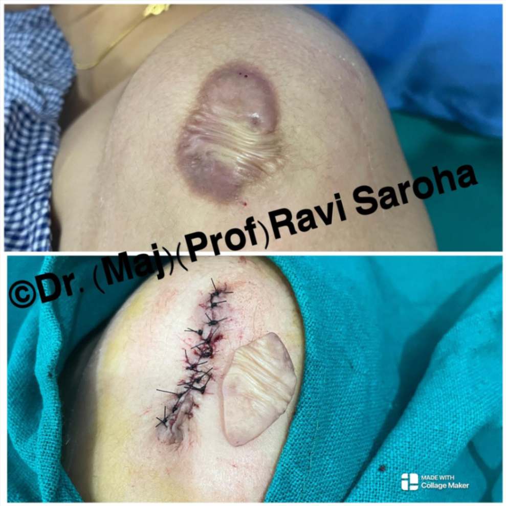 Body Surgery