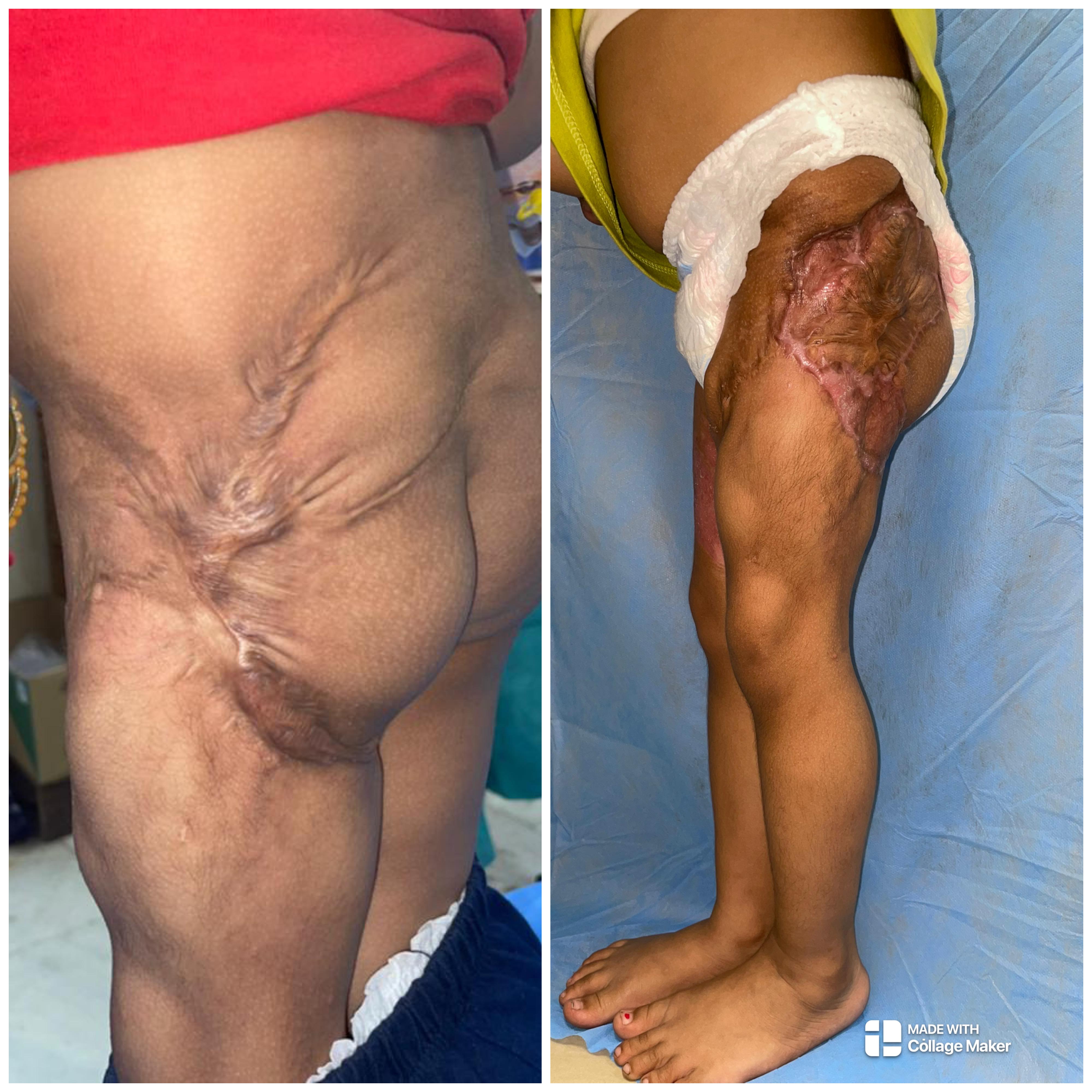 Body Surgery