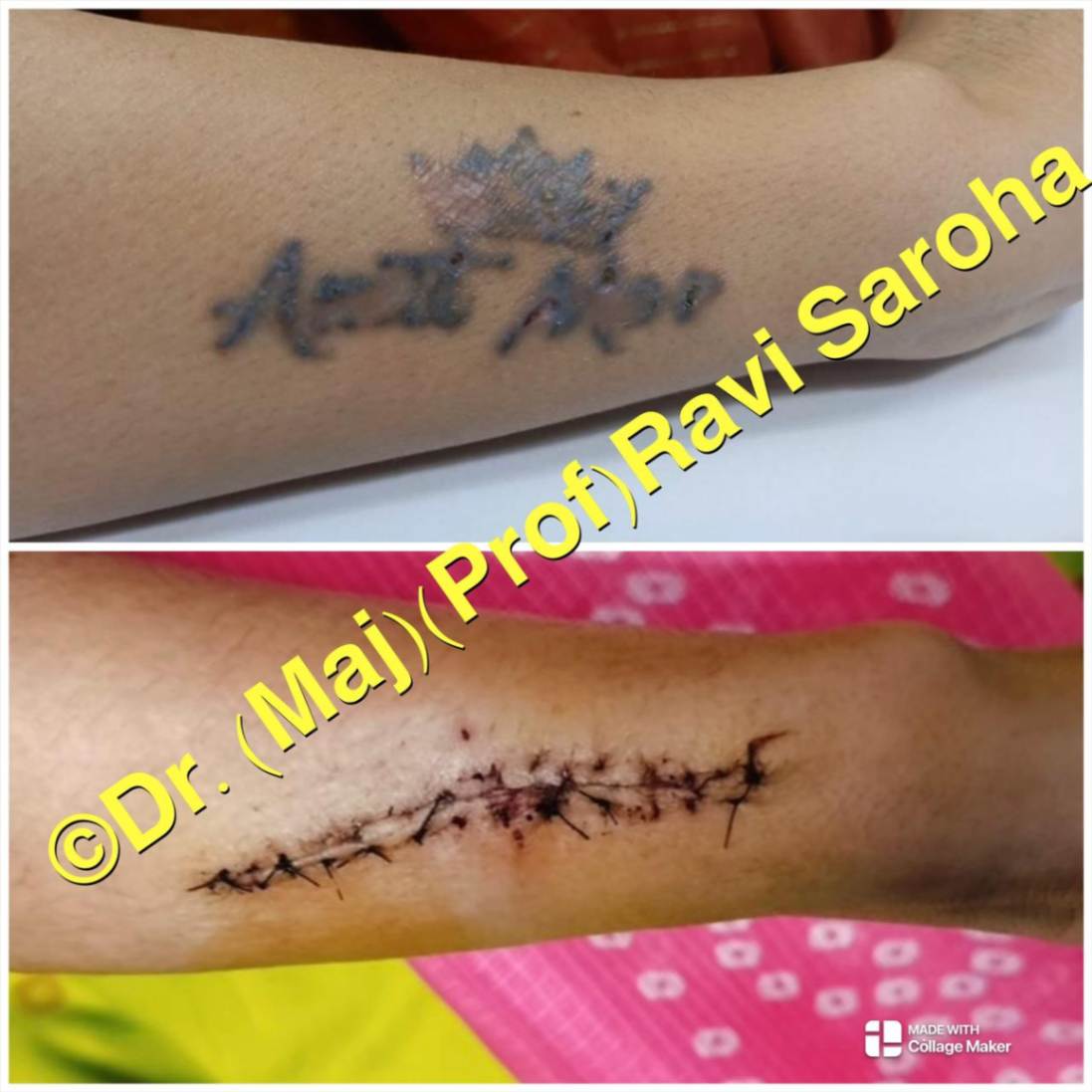 Body Surgery