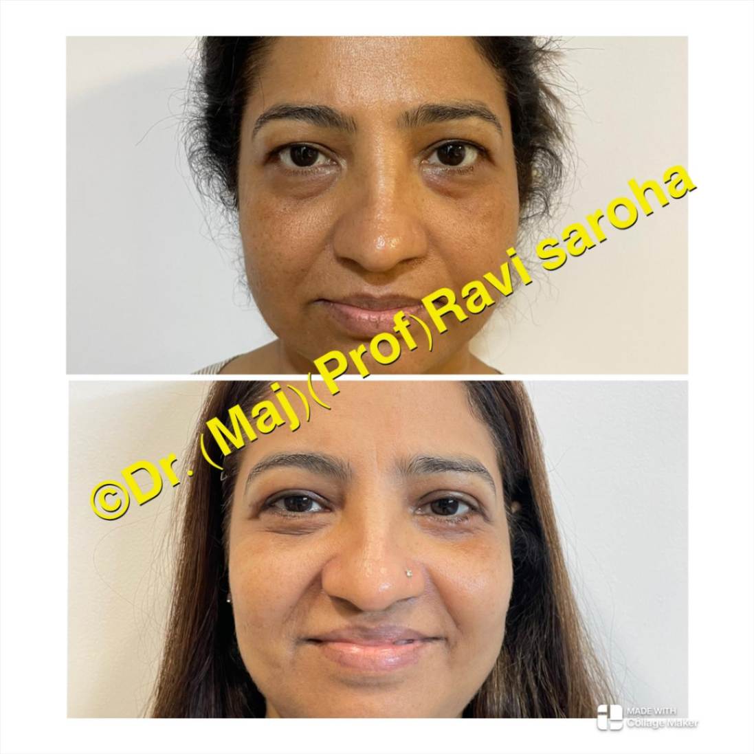 Facial Surgery