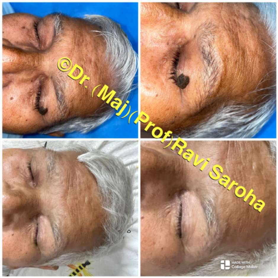 Facial Surgery