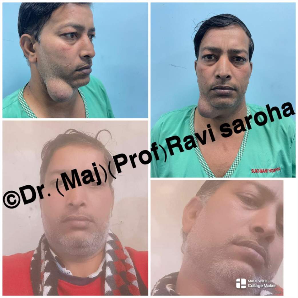 Facial Surgery