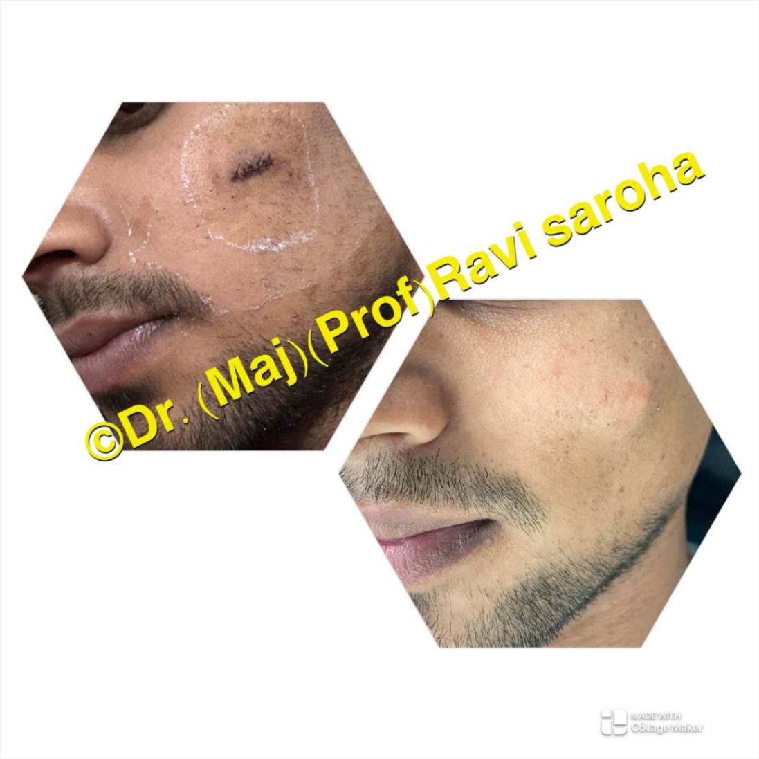 Facial Surgery
