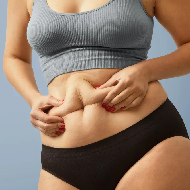 Abdminoplasty